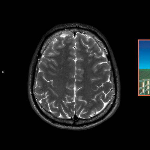 Promo van CLUB LAAT: Blauwdruk &amp; THIRDFLOOR • Club Wintercircus, in opdracht van Club Wintercircus, VIERNULVIER en THIRD FLOOR